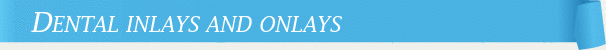 Dentist Marietta Dental Inlays and Onlays